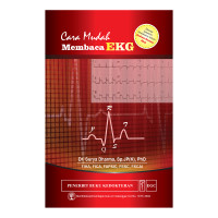 Image of Cara Mudah Membaca EKG