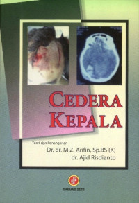 Image of Cedera Kepala :  Teori dan Penanganan
